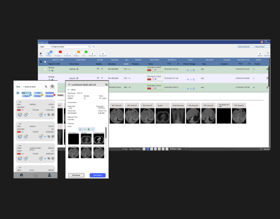 PACS (Picture archiving and communication system)