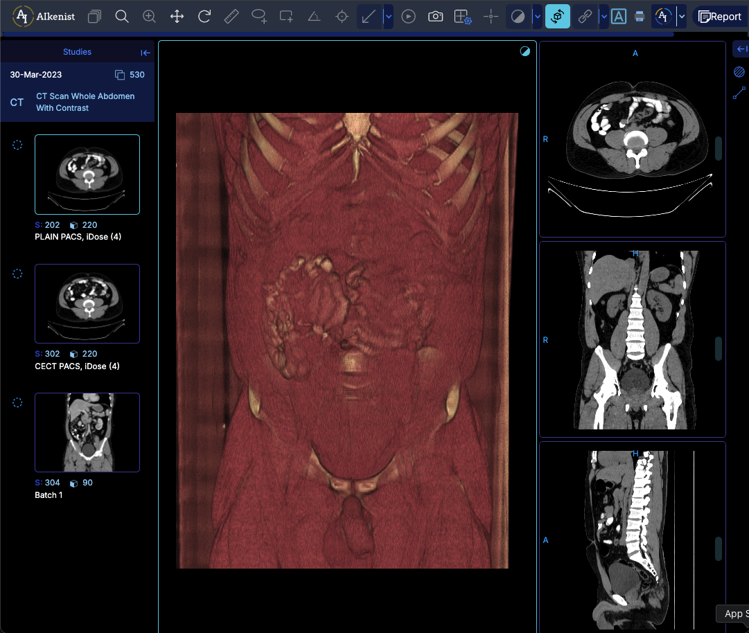DICOM Viewer